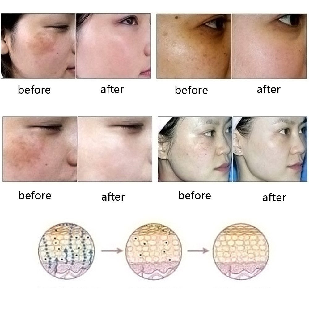Dredge Meridian Skin Care Natural Pure Removal