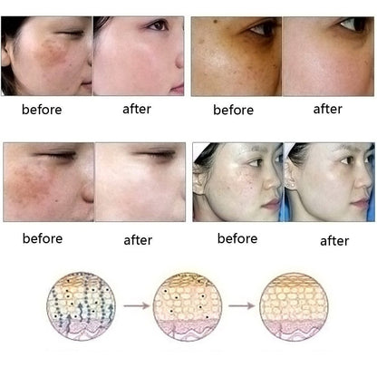 Dredge Meridian Skin Care Natural Pure Removal